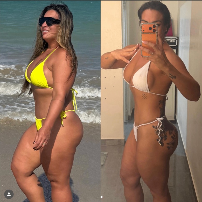 Resultado antes e depois do tratamento